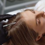 A Comprehensive Guide To Mesotherapy For Hair